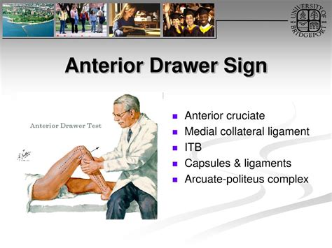 positive anterior drawer sign